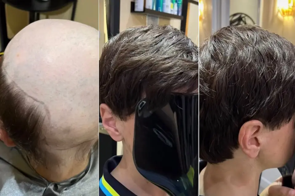 Hair Replacement by joelle - Beauty Lounge by Joelle Hair Replacement by joelle