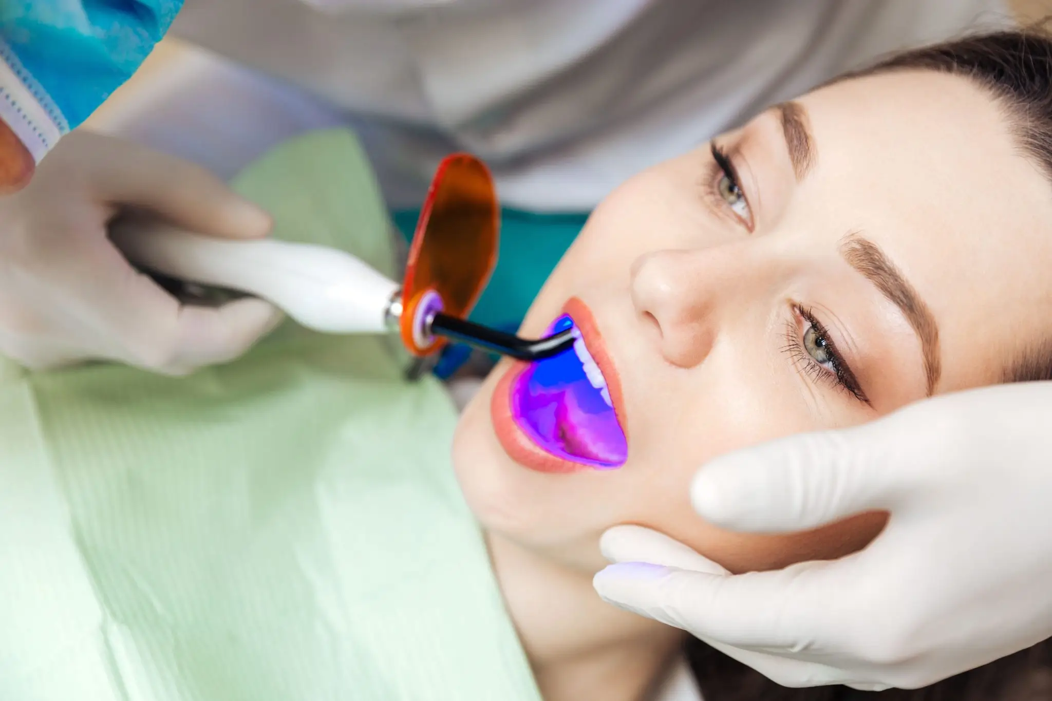 Whitening Application - Beauty Lounge by Joelle