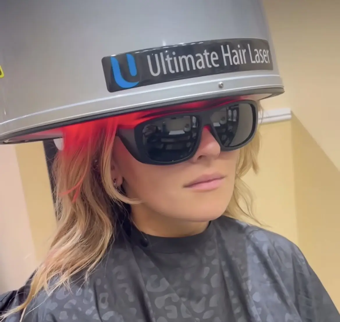Hair Loss 1 - Beauty Lounge by Joelle Hair Loss