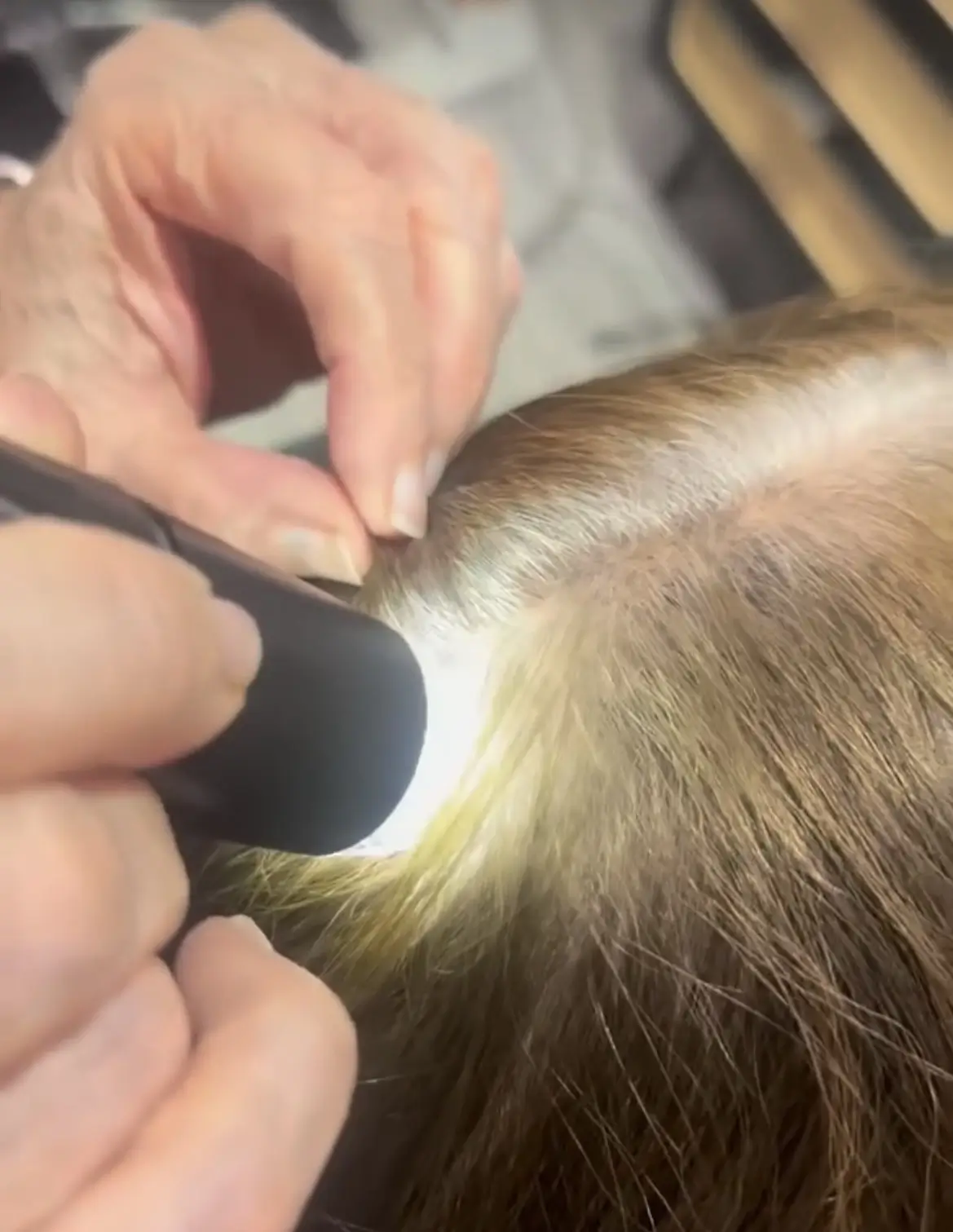 Hair Loss 3 - Beauty Lounge by Joelle Hair Loss