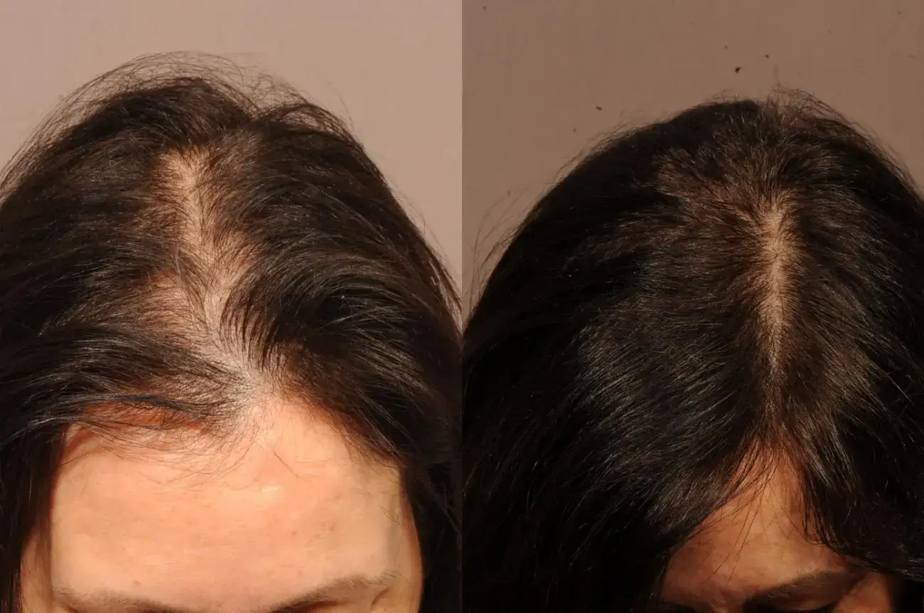 Advanced Hair Replacement Systems - Beauty Lounge by Joelle Advanced Hair Replacement Systems