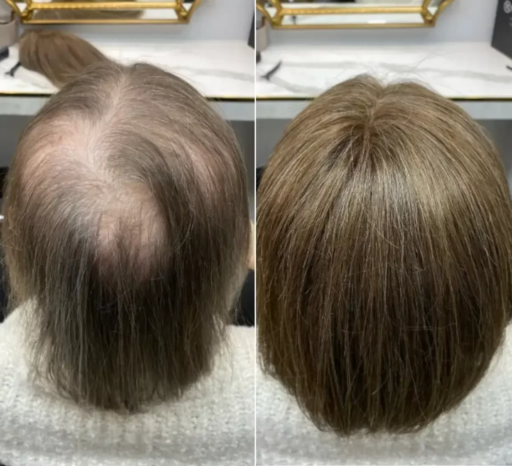 Medical Wigs - Real Results 3 - Beauty Lounge by Joelle Medical Wigs - Real Results 3