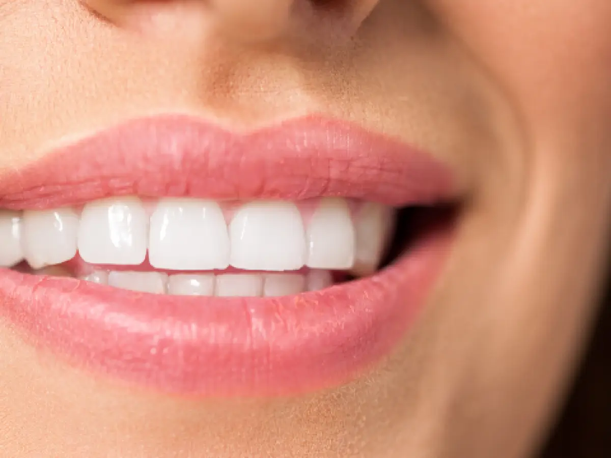 What Is Teeth Whitening - Beauty Lounge by Joelle What Is Teeth Whitening
