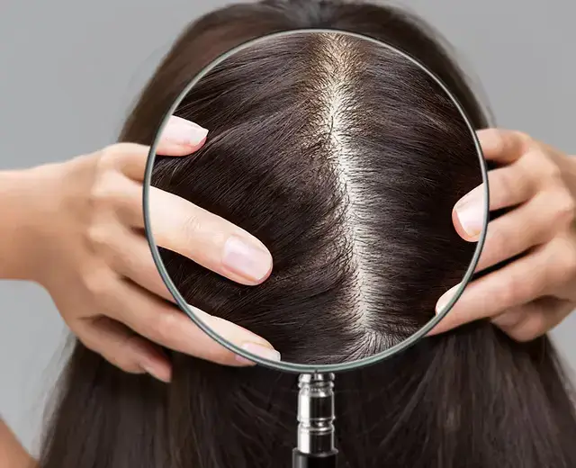 scalp analysis - Beauty Lounge by Joelle scalp analysis