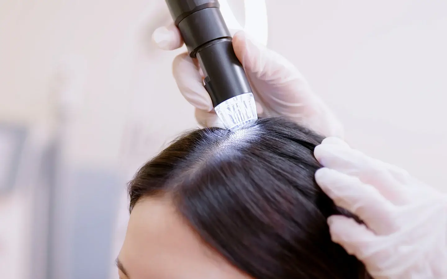 scalp consultation - Beauty Lounge by Joelle scalp consultation
