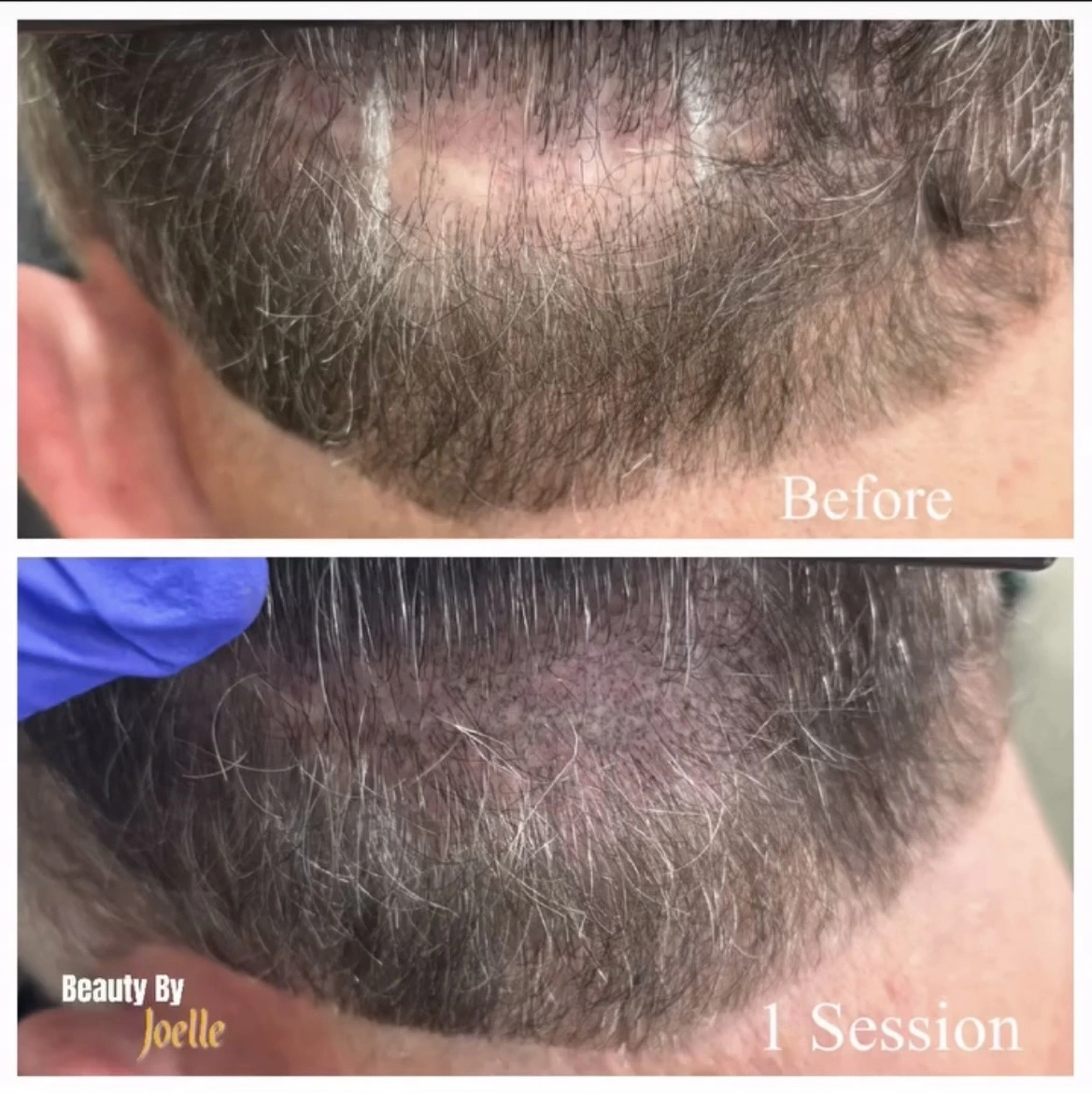 scalp mircropigmentation - Beauty Lounge by Joelle